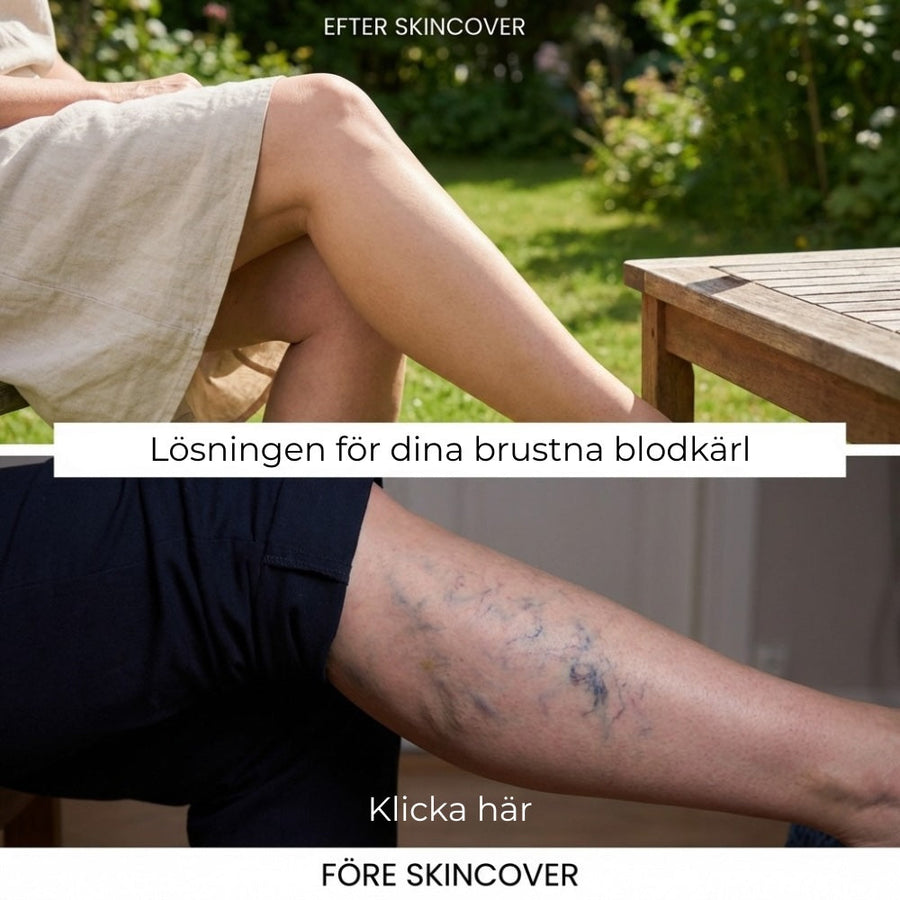 Sådan ser det ud på rigtig hud
